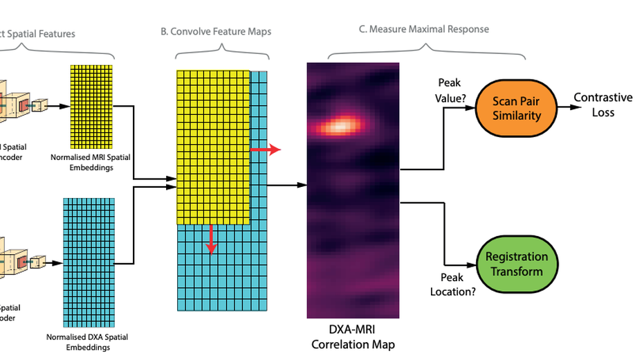 PaperView - Self-supervised multi-modal alignment for whole body medical imaging